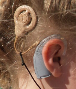 Enfant porteur d'un implant cochléaire